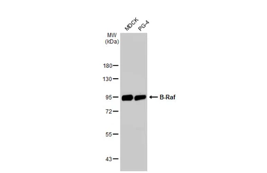 Anti-B-Raf antibody [HL1606] used in Western Blot (WB). GTX637085