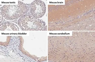 Anti-B-Raf antibody [HL1606] used in IHC (Paraffin sections) (IHC-P). GTX637085