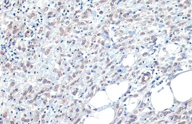 Anti-B-Raf antibody [HL1606] used in IHC (Paraffin sections) (IHC-P). GTX637085