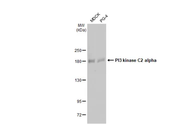 Anti-PI3 kinase C2 alpha antibody [HL1612] used in Western Blot (WB). GTX637103