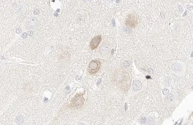 Anti-PI3 kinase C2 alpha antibody [HL1612] used in IHC (Paraffin sections) (IHC-P). GTX637103
