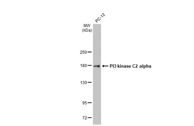 Anti-PI3 kinase C2 alpha antibody [HL1612] used in Western Blot (WB). GTX637103