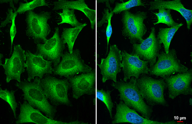 Anti-STAM antibody [HL1635] used in Immunocytochemistry/ Immunofluorescence (ICC/IF). GTX637128
