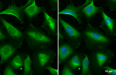 Anti-STAM antibody [HL1637] used in Immunocytochemistry/ Immunofluorescence (ICC/IF). GTX637130