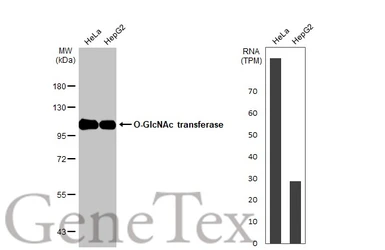 Anti-O-GlcNAc transferase antibody [HL1642] used in Western Blot (WB). GTX637223