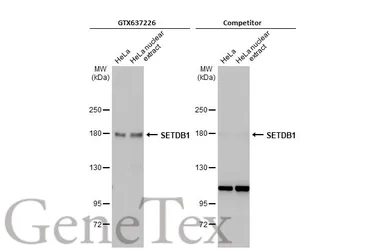 Anti-SETDB1 antibody [HL1645] used in Western Blot (WB). GTX637226