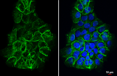 Anti-CD44 antibody [HL1650] used in Immunocytochemistry/ Immunofluorescence (ICC/IF). GTX637231