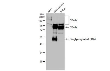 Anti-CD44 antibody [HL1650] used in Western Blot (WB). GTX637231
