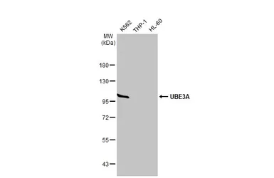 Anti-UBE3A antibody [HL1660] used in Western Blot (WB). GTX637258
