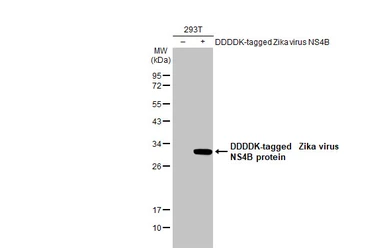 Anti-Zika virus NS4B protein antibody [HL1663] used in Western Blot (WB). GTX637261