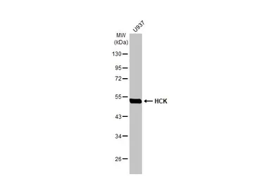 Anti-HCK antibody [HL1673] used in Western Blot (WB). GTX637272