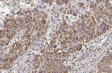Anti-HCK antibody [HL1673] used in IHC (Paraffin sections) (IHC-P). GTX637272