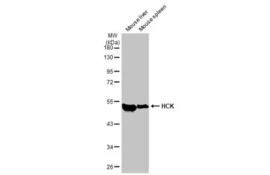 Anti-HCK antibody [HL1673] used in Western Blot (WB). GTX637272