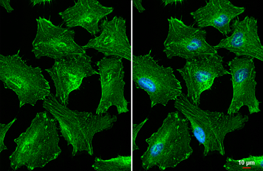 Anti-alpha Actinin antibody [HL1692] used in Immunocytochemistry/ Immunofluorescence (ICC/IF). GTX637291