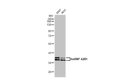 Anti-hnRNP A2B1 antibody [HL1706] used in Western Blot (WB). GTX637305