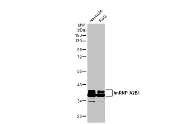 Anti-hnRNP A2B1 antibody [HL1706] used in Western Blot (WB). GTX637305