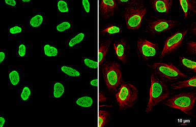 Anti-hnRNP A2B1 antibody [HL1706] used in Immunocytochemistry/ Immunofluorescence (ICC/IF). GTX637305