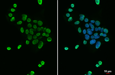 Anti-hnRNP A2B1 antibody [HL1706] used in Immunocytochemistry/ Immunofluorescence (ICC/IF). GTX637305