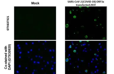 Anti-SARS-CoV-2 (COVID-19) ORF3a antibody [HL1722] used in IHC-P (cell pellet) (IHC-P (cell pellet)). GTX637321
