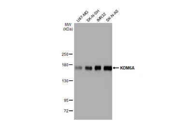 Anti-KDM6A antibody [HL1731] used in Western Blot (WB). GTX637379