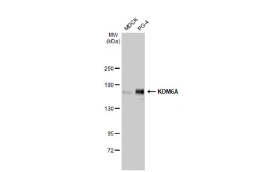 Anti-KDM6A antibody [HL1731] used in Western Blot (WB). GTX637379