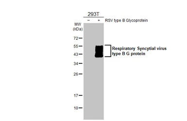 Anti-Respiratory Syncytial virus type B G protein antibody [HL1733] used in Western Blot (WB). GTX637381