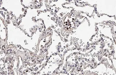 Anti-TREM2 antibody [HL1738] used in IHC (Paraffin sections) (IHC-P). GTX637386