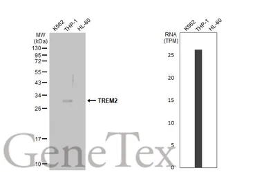 Anti-TREM2 antibody [HL1739] used in Western Blot (WB). GTX637387