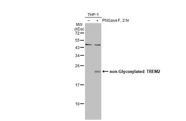 Anti-TREM2 antibody [HL1739] used in Western Blot (WB). GTX637387
