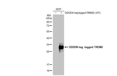 Anti-TREM2 antibody [HL1739] used in Western Blot (WB). GTX637387