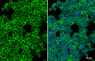 Anti-TREM2 antibody [HL1739] used in Immunocytochemistry/ Immunofluorescence (ICC/IF). GTX637387