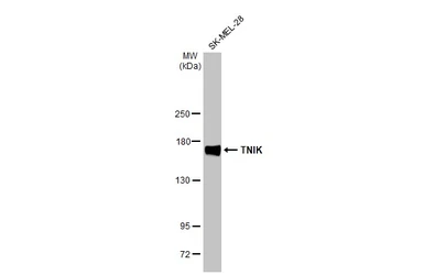 Anti-TNIK antibody [HL1751] used in Western Blot (WB). GTX637401