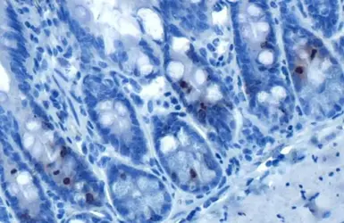 Anti-Histone H3S10ph (phospho Ser10) antibody [HL1752] used in IHC (Paraffin sections) (IHC-P). GTX637402