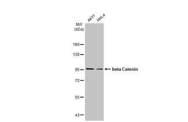 Anti-beta Catenin antibody [HL1753] used in Western Blot (WB). GTX637403