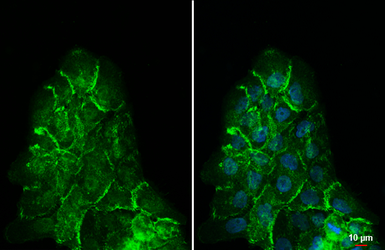 Anti-beta Catenin antibody [HL1753] used in Immunocytochemistry/ Immunofluorescence (ICC/IF). GTX637403