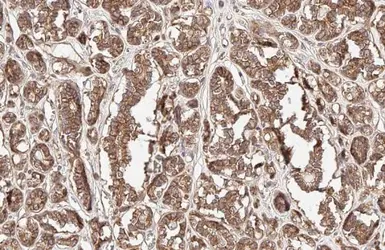 Anti-beta Catenin antibody [HL1753] used in IHC (Paraffin sections) (IHC-P). GTX637403