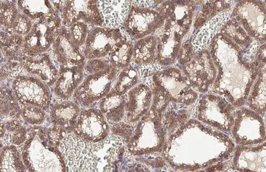 Anti-beta Catenin antibody [HL1753] used in IHC (Paraffin sections) (IHC-P). GTX637403