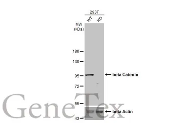 Anti-beta Catenin antibody [HL1753] used in Western Blot (WB). GTX637403