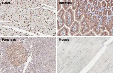 Anti-beta Catenin antibody [HL1753] used in IHC (Paraffin sections) (IHC-P). GTX637403