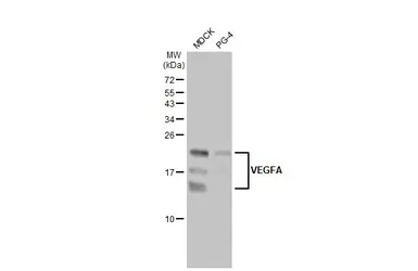Anti-VEGFA antibody [HL1755] used in Western Blot (WB). GTX637405