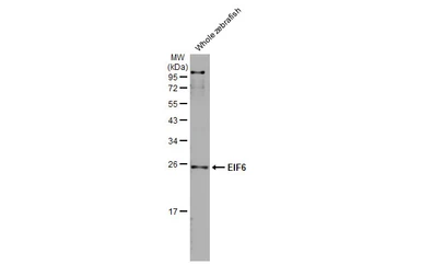 Anti-EIF6 antibody [HL1758] used in Western Blot (WB). GTX637408
