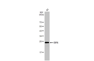 Anti-EIF6 antibody [HL1758] used in Western Blot (WB). GTX637408