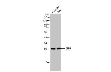 Anti-EIF6 antibody [HL1758] used in Western Blot (WB). GTX637408
