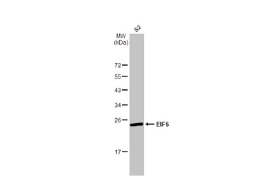 Anti-EIF6 antibody [HL1759] used in Western Blot (WB). GTX637409