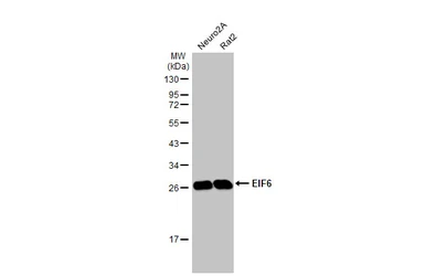 Anti-EIF6 antibody [HL1759] used in Western Blot (WB). GTX637409