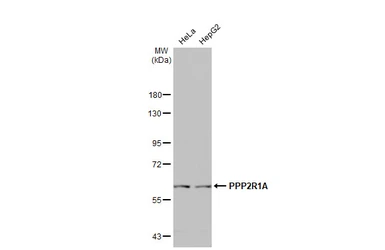 Anti-PPP2R1A antibody [HL1781] used in Western Blot (WB). GTX637433