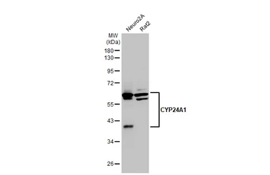 Anti-CYP24A1 antibody [HL1783] used in Western Blot (WB). GTX637435