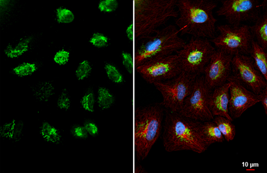 Anti-CYP24A1 antibody [HL1783] used in Immunocytochemistry/ Immunofluorescence (ICC/IF). GTX637435