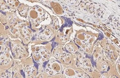 Anti-Mig-6 antibody [HL1785] used in IHC (Paraffin sections) (IHC-P). GTX637437