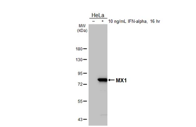 Anti-MX1 antibody [HL1790] used in Western Blot (WB). GTX637442